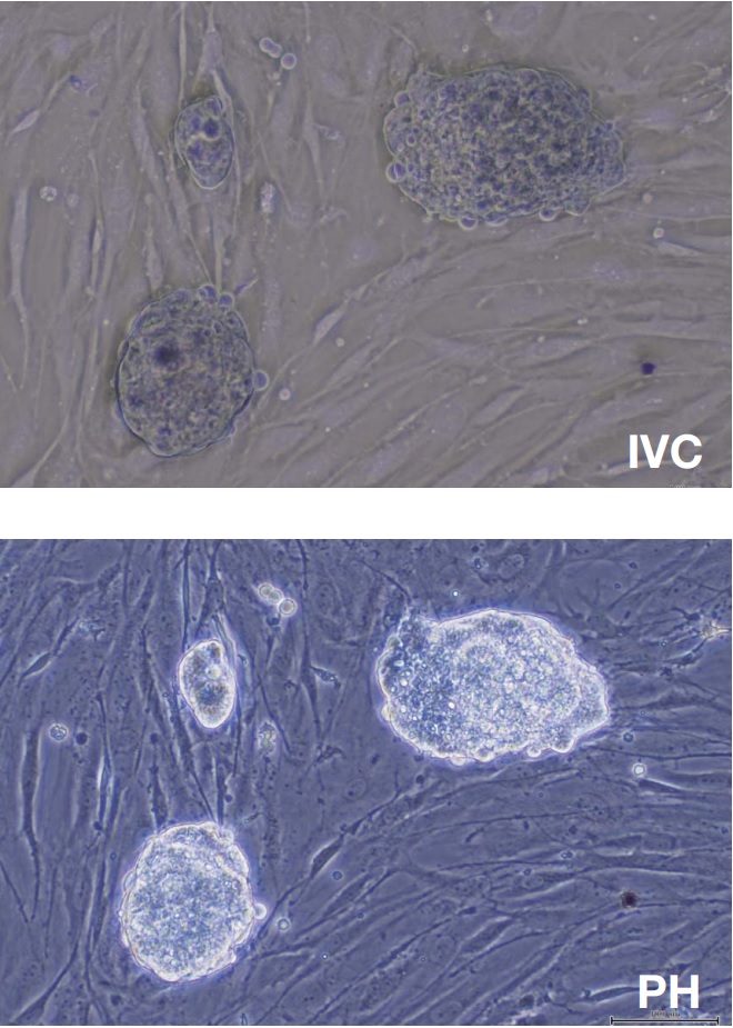 Contraste de phase inversé (IVC)