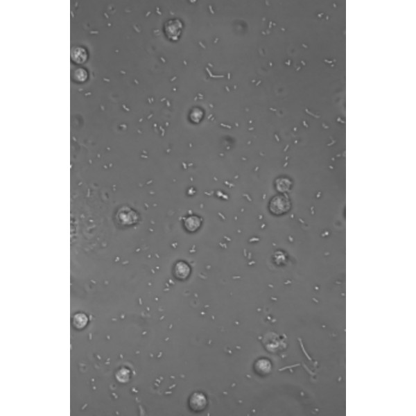 Hund Microscopio Medicus PH Plan, trino, 100x-1000x