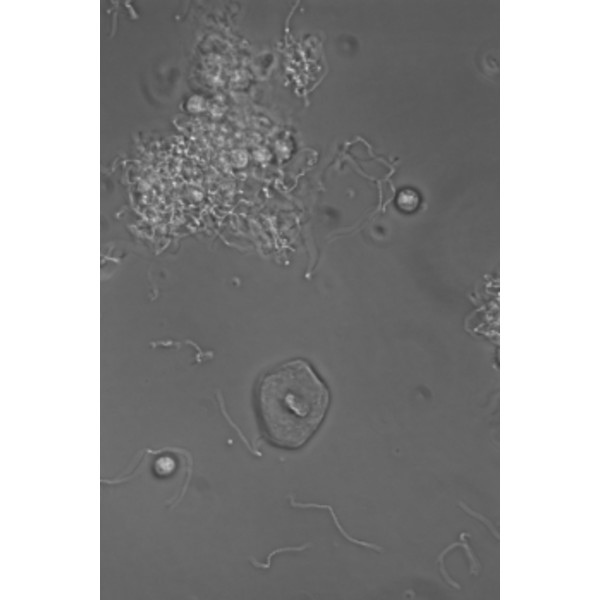 Hund Microscopio Medicus PH Plan, trino, 100x-1000x