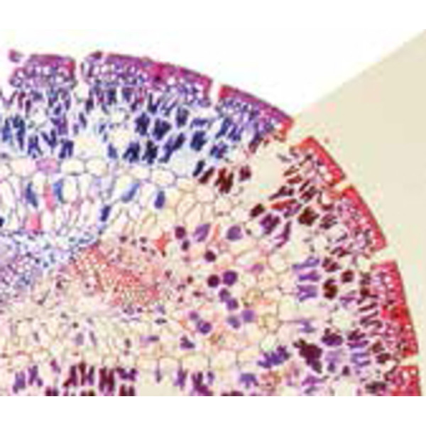 Optika Microscopio Mikroskop B-383PHiIVD, trino, phase, N-PLAN, IOS, 40x-1000x, EU, IVD