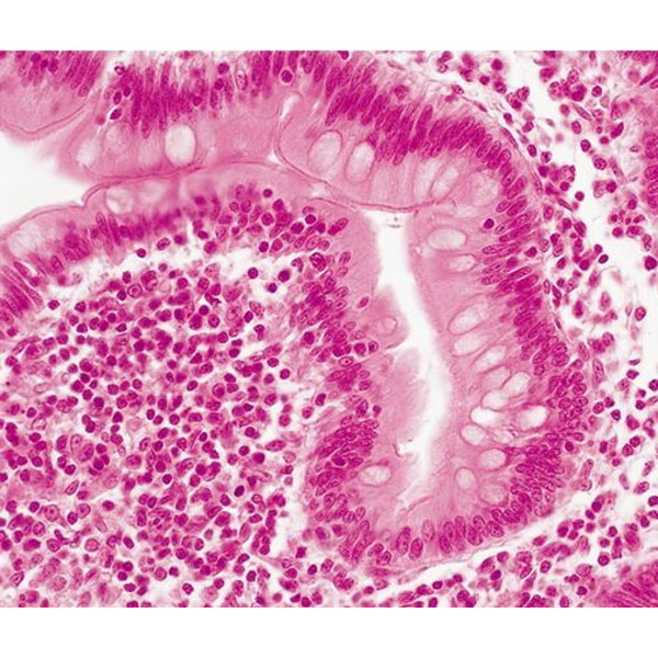 Evident Olympus Microscopio CX31 bino, Hal, 40x,100x, 400x