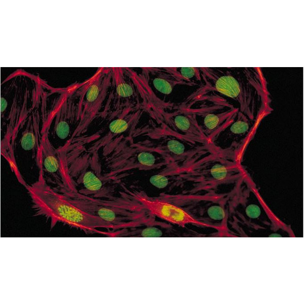 Evident Olympus Microscopio CX41 Fluorescenza, trino, alogeno, 40x, 100x, 400x