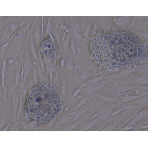 Evident Olympus Microscopio invertito CKX53, trinoculare, 100x, 200x, 400x, IPC/IVC tavolino x/y