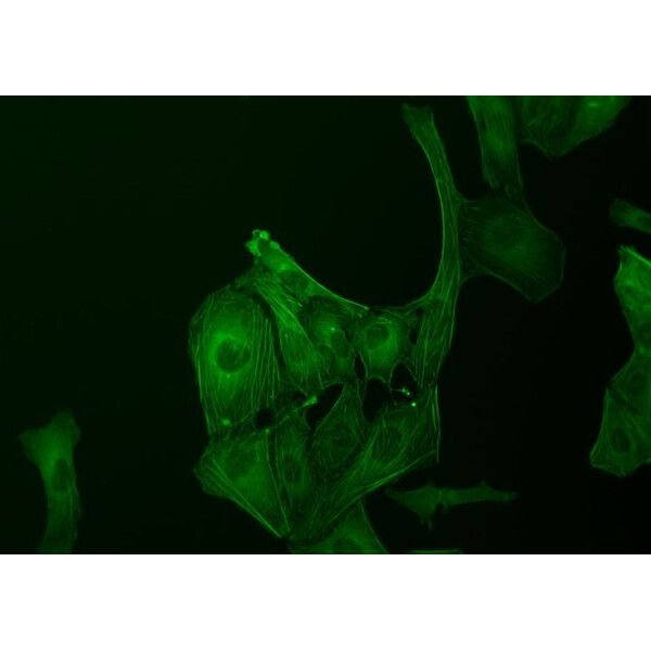 ZEISS Microscopio invertito Primovert bino Ph1, 40x, 100x, Cond 0.3