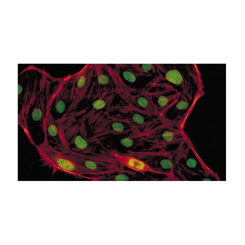 Evident Olympus Microscopio CX41 Fluorescenza, trino, alogeno, 40x, 100x, 400x