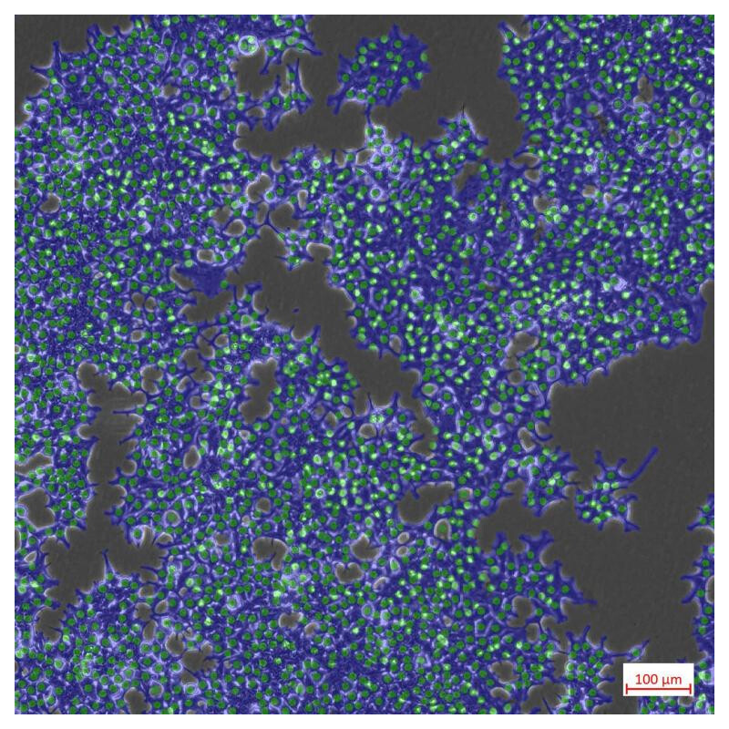 ZEISS Microscopio Axiovert 5 Digital, PH, FL, 50-400x, Ph1, 0.4 NA, LED, 5 MP, mono