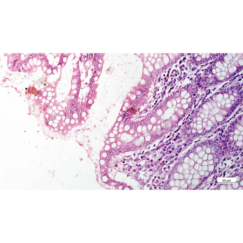 ZEISS Microscopio Axiovert 5 Digital, PH, FL, 50-400x, Ph1, 0.4 NA, LED, 5 MP, mono